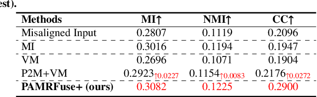 Figure 2 for Performance of Medical Image Fusion in High-level Analysis Tasks: A Mutual Enhancement Framework for Unaligned PAT and MRI Image Fusion