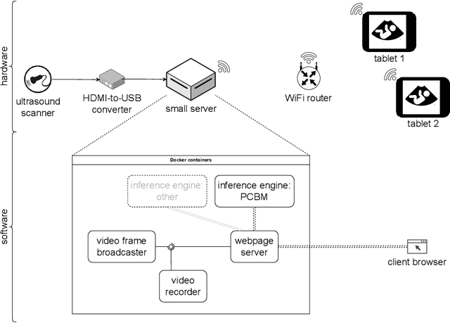 Figure 1 for Deployment of Deep Learning Model in Real World Clinical Setting: A Case Study in Obstetric Ultrasound