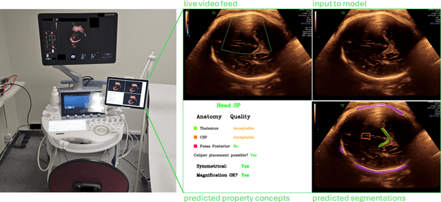 Figure 2 for Deployment of Deep Learning Model in Real World Clinical Setting: A Case Study in Obstetric Ultrasound