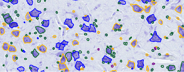 Figure 2 for Automated Classification of Cell Shapes: A Comparative Evaluation of Shape Descriptors