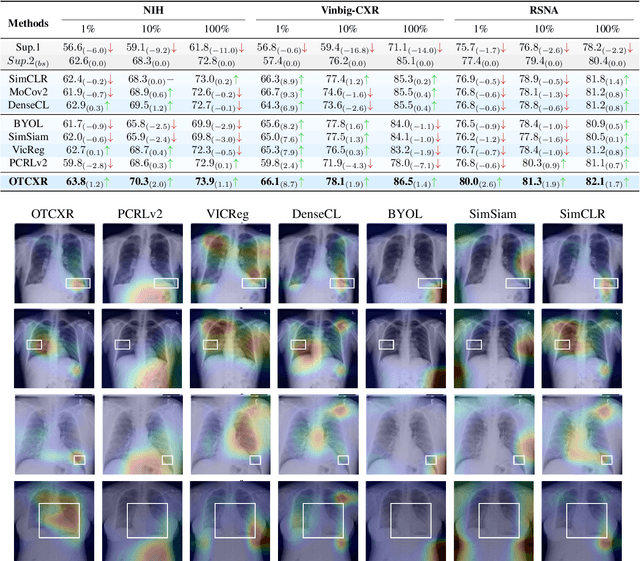 Figure 3 for OPTiML: Dense Semantic Invariance Using Optimal Transport for Self-Supervised Medical Image Representation