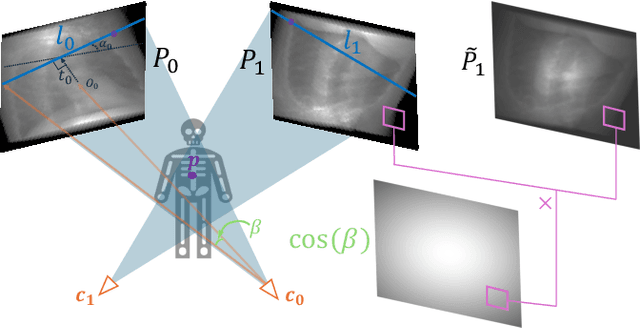 Figure 1 for Epi-NAF: Enhancing Neural Attenuation Fields for Limited-Angle CT with Epipolar Consistency Conditions