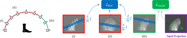 Figure 3 for Epi-NAF: Enhancing Neural Attenuation Fields for Limited-Angle CT with Epipolar Consistency Conditions