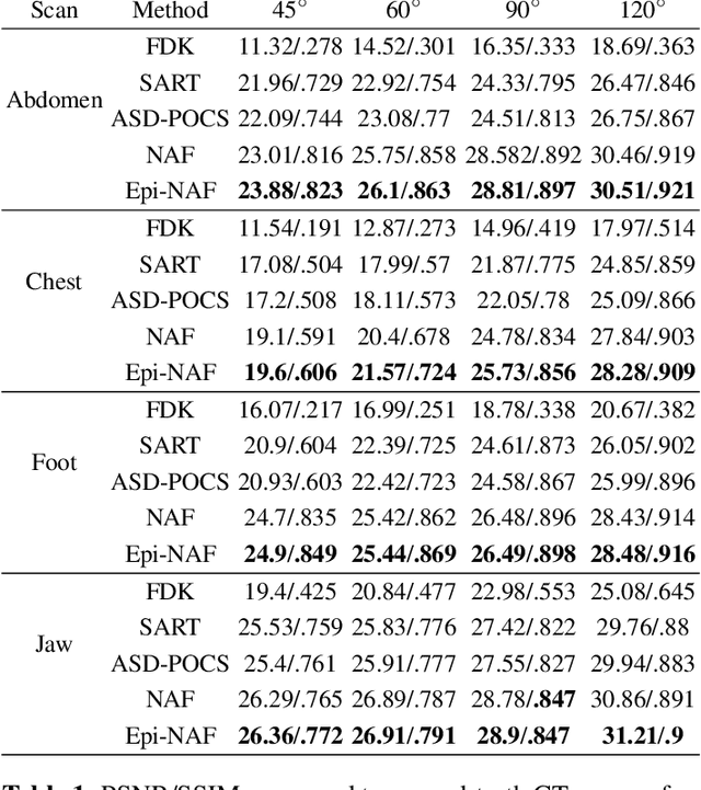 Figure 2 for Epi-NAF: Enhancing Neural Attenuation Fields for Limited-Angle CT with Epipolar Consistency Conditions