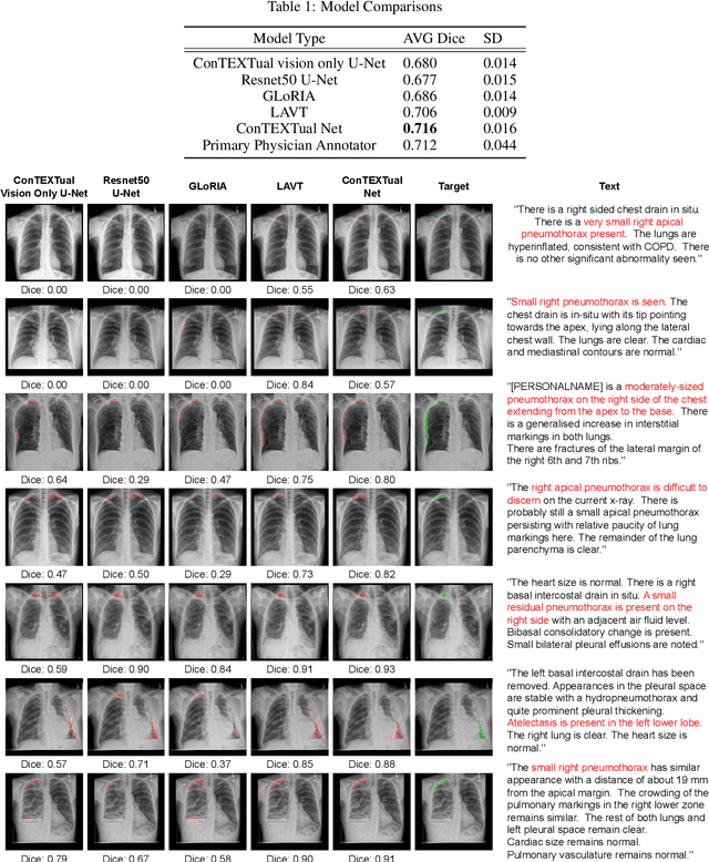 Figure 2 for ConTEXTual Net: A Multimodal Vision-Language Model for Segmentation of Pneumothorax