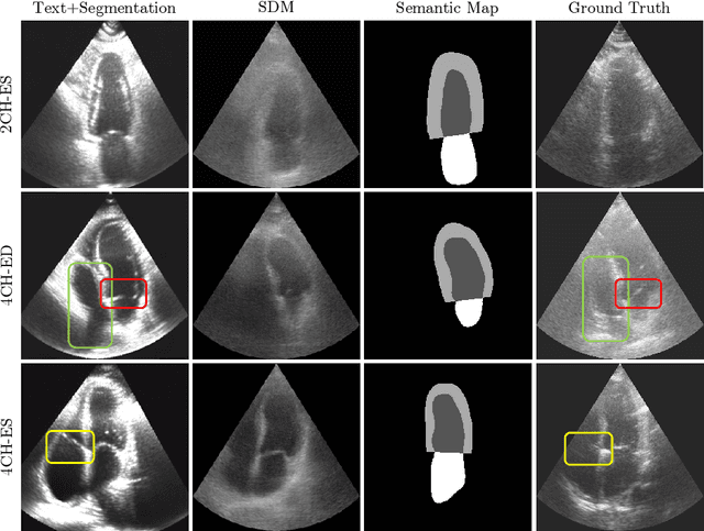 Figure 3 for Vision-Language Synthetic Data Enhances Echocardiography Downstream Tasks