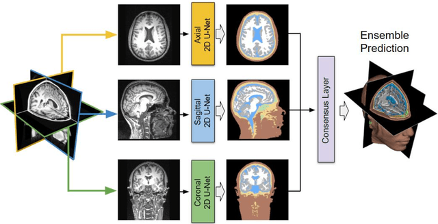 Figure 2 for Full-Head Segmentation of MRI with Abnormal Brain Anatomy: Model and Data Release