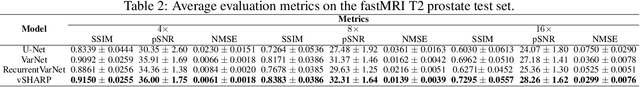 Figure 4 for vSHARP: variable Splitting Half-quadratic ADMM algorithm for Reconstruction of inverse-Problems