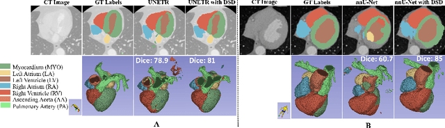 Figure 2 for Dual self-distillation of U-shaped networks for 3D medical image segmentation