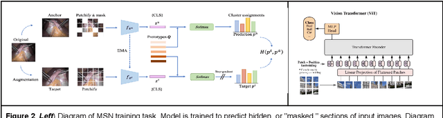 Figure 2 for Predicting Generalization of AI Colonoscopy Models to Unseen Data