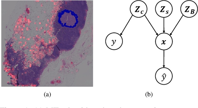 Figure 1 for Attention Is Not What You Need: Revisiting Multi-Instance Learning for Whole Slide Image Classification