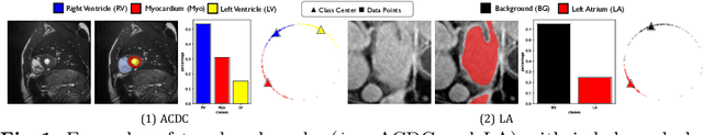 Figure 1 for ACTION++: Improving Semi-supervised Medical Image Segmentation with Adaptive Anatomical Contrast