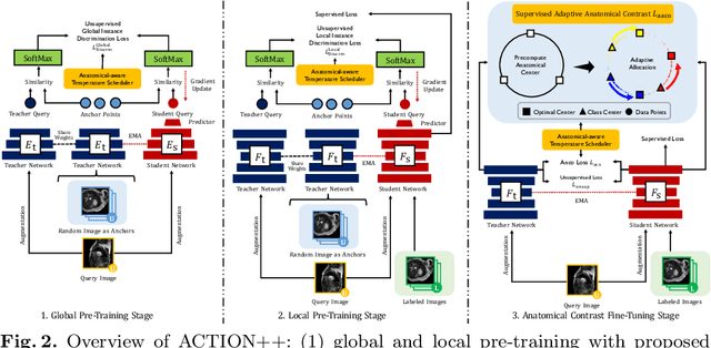 Figure 3 for ACTION++: Improving Semi-supervised Medical Image Segmentation with Adaptive Anatomical Contrast