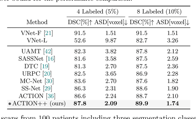 Figure 2 for ACTION++: Improving Semi-supervised Medical Image Segmentation with Adaptive Anatomical Contrast