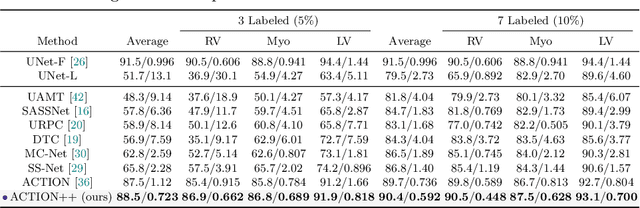 Figure 4 for ACTION++: Improving Semi-supervised Medical Image Segmentation with Adaptive Anatomical Contrast