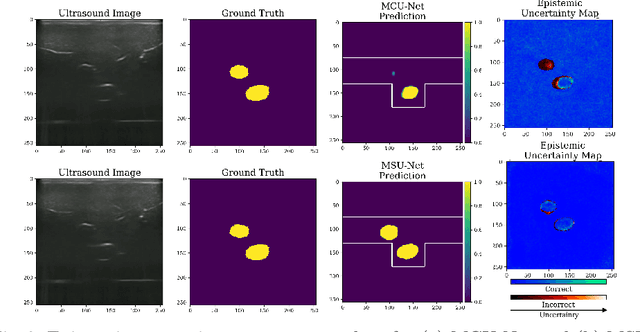 Figure 3 for Enhanced Uncertainty Estimation in Ultrasound Image Segmentation with MSU-Net