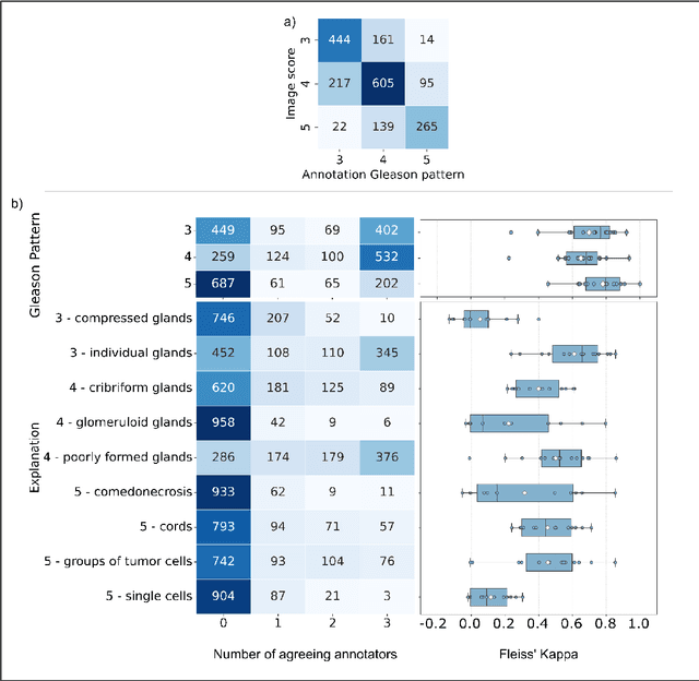 Figure 3 for Pathologist-like explainable AI for interpretable Gleason grading in prostate cancer