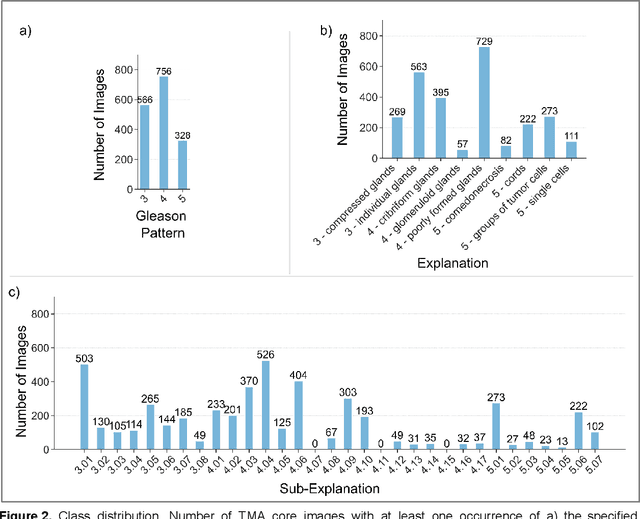 Figure 2 for Pathologist-like explainable AI for interpretable Gleason grading in prostate cancer