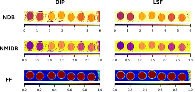 Figure 1 for Chemical Shift Encoding based Double Bonds Quantification in Triglycerides using Deep Image Prior