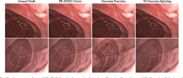 Figure 2 for PR-ENDO: Physically Based Relightable Gaussian Splatting for Endoscopy