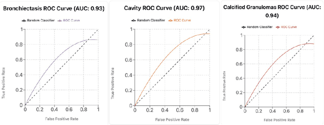 Figure 4 for Advancing Chronic Tuberculosis Diagnostics Using Vision-Language Models: A Multi modal Framework for Precision Analysis