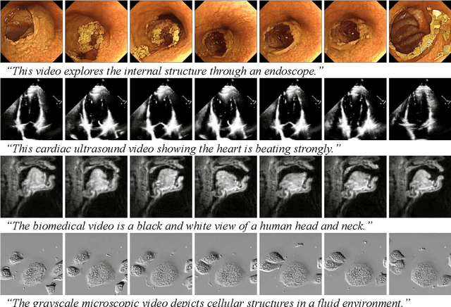 Figure 3 for Bora: Biomedical Generalist Video Generation Model