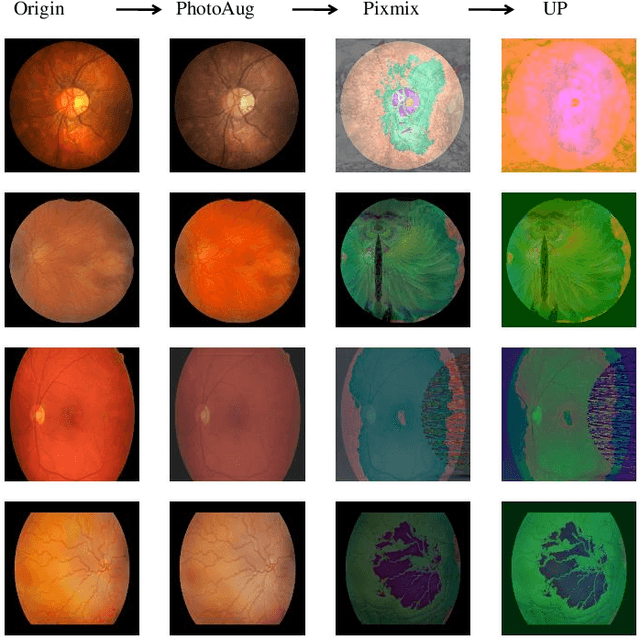 Figure 3 for DGSSA: Domain generalization with structural and stylistic augmentation for retinal vessel segmentation