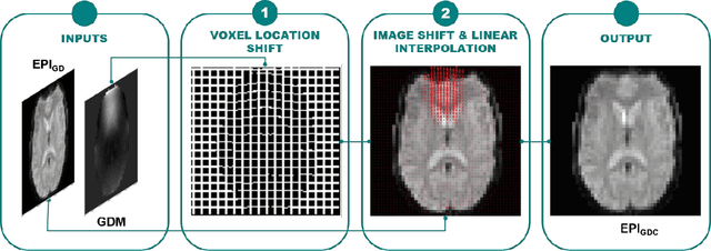 Figure 3 for GDCNet: Calibrationless geometric distortion correction of echo planar imaging data using deep learning