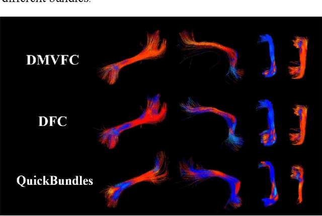 Figure 4 for A Novel Deep Learning Tractography Fiber Clustering Framework for Functionally Consistent White Matter Parcellation Using Multimodal Diffusion MRI and Functional MRI