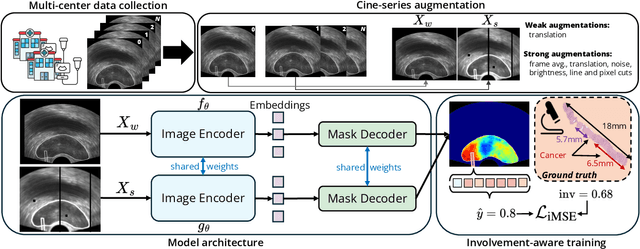 Figure 1 for Cinepro: Robust Training of Foundation Models for Cancer Detection in Prostate Ultrasound Cineloops
