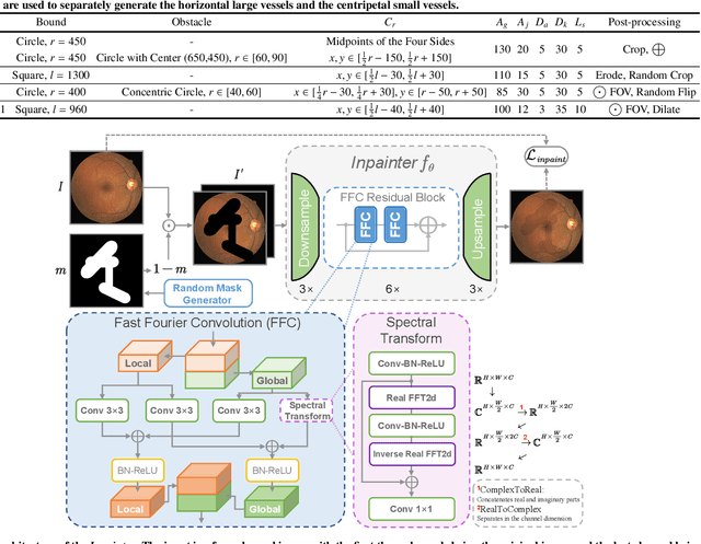 Figure 2 for YoloCurvSeg: You Only Label One Noisy Skeleton for Vessel-style Curvilinear Structure Segmentation