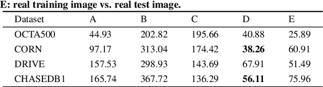 Figure 4 for YoloCurvSeg: You Only Label One Noisy Skeleton for Vessel-style Curvilinear Structure Segmentation