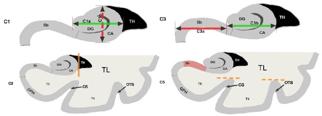 Figure 1 for Automatic rating of incomplete hippocampal inversions evaluated across multiple cohorts