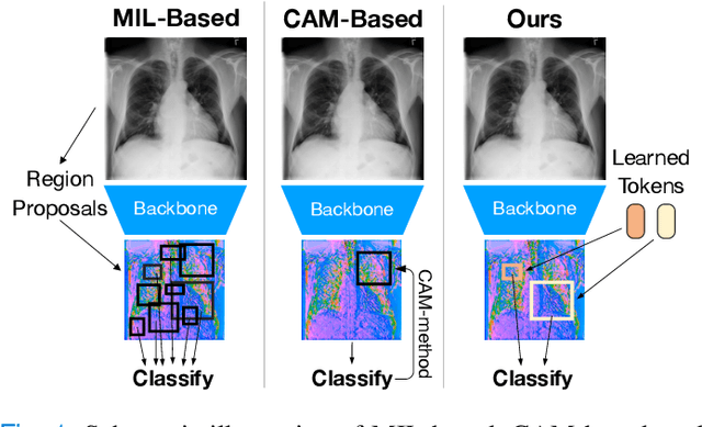 Figure 1 for Weakly Supervised Object Detection in Chest X-Rays with Differentiable ROI Proposal Networks and Soft ROI Pooling