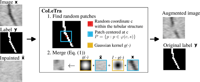 Figure 3 for Disconnect to Connect: A Data Augmentation Method for Improving Topology Accuracy in Image Segmentation