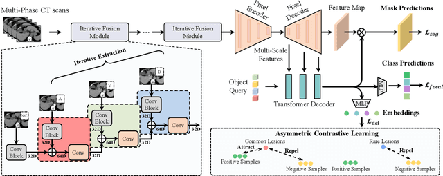 Figure 1 for LIDIA: Precise Liver Tumor Diagnosis on Multi-Phase Contrast-Enhanced CT via Iterative Fusion and Asymmetric Contrastive Learning