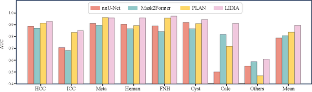 Figure 3 for LIDIA: Precise Liver Tumor Diagnosis on Multi-Phase Contrast-Enhanced CT via Iterative Fusion and Asymmetric Contrastive Learning