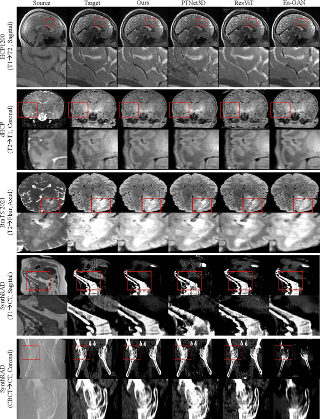 Figure 3 for Multi-resolution Guided 3D GANs for Medical Image Translation