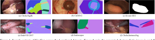 Figure 1 for SimGen: A Diffusion-Based Framework for Simultaneous Surgical Image and Segmentation Mask Generation