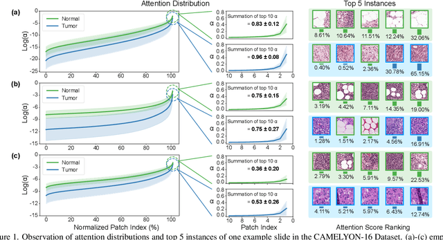 Figure 1 for Shapley Values-enabled Progressive Pseudo Bag Augmentation for Whole Slide Image Classification