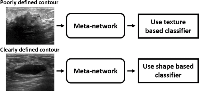 Figure 3 for Deep meta-learning for the selection of accurate ultrasound based breast mass classifier