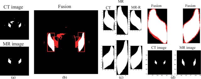 Figure 3 for Weakly supervised alignment and registration of MR-CT for cervical cancer radiotherapy