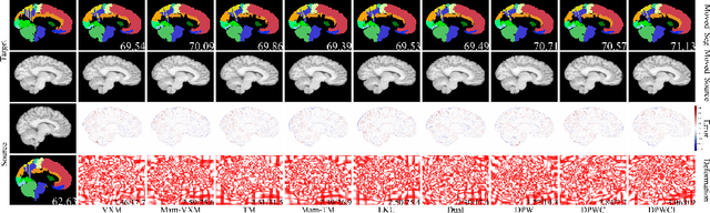 Figure 4 for Mamba? Catch The Hype Or Rethink What Really Helps for Image Registration