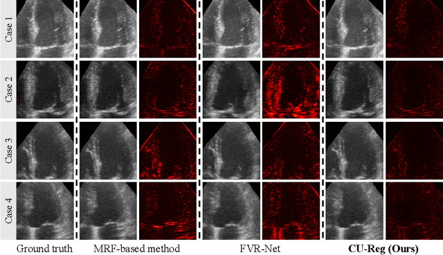 Figure 4 for Epicardium Prompt-guided Real-time Cardiac Ultrasound Frame-to-volume Registration