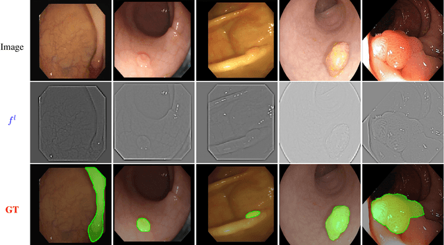 Figure 3 for MEGANet: Multi-Scale Edge-Guided Attention Network for Weak Boundary Polyp Segmentation