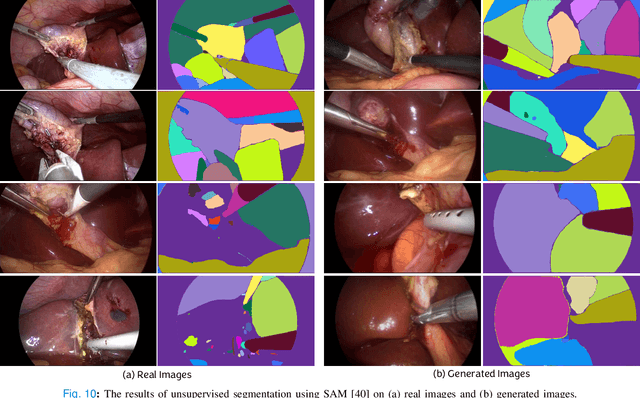 Figure 1 for Surgical Text-to-Image Generation