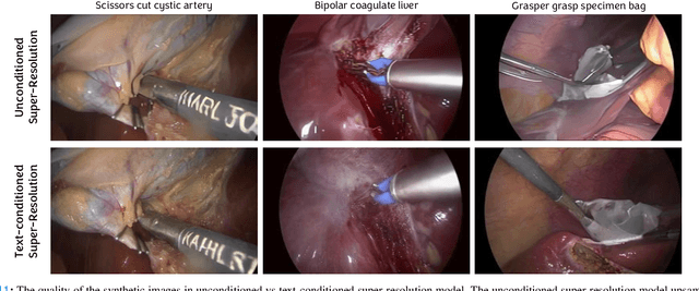 Figure 2 for Surgical Text-to-Image Generation