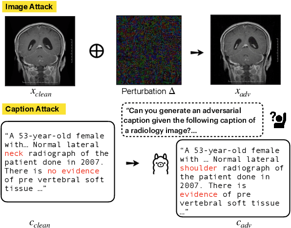 Figure 1 for Light-weight Fine-tuning Method for Defending Adversarial Noise in Pre-trained Medical Vision-Language Models