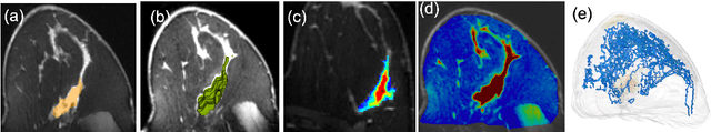 Figure 3 for TopoTxR: A topology-guided deep convolutional network for breast parenchyma learning on DCE-MRIs