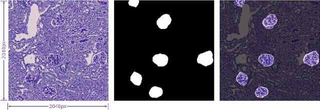 Figure 3 for CovHuSeg: An Enhanced Approach for Kidney Pathology Segmentation